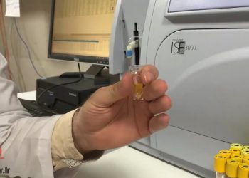 تست سدیم